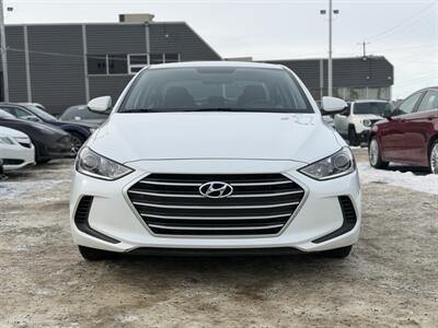2017 Hyundai ELANTRA SE *ONE OWNER, NO ACCIDENTS*   - Photo 2 - Edmonton, AB T5S 1R1